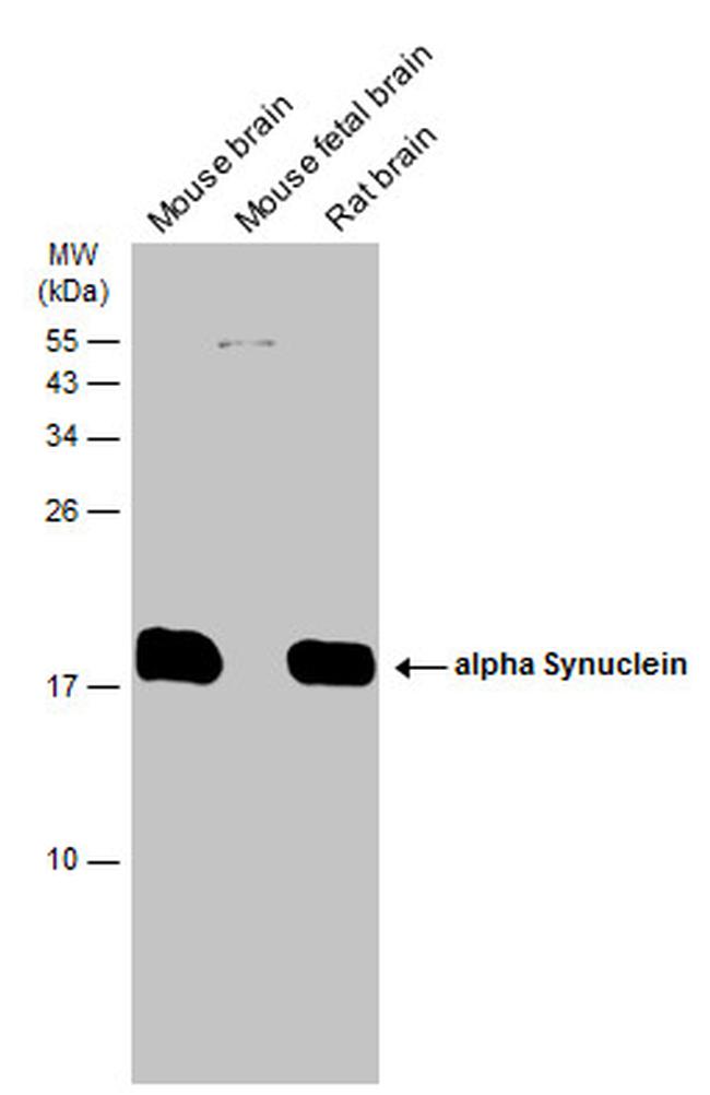 alpha Synuclein Antibody in Western Blot (WB)