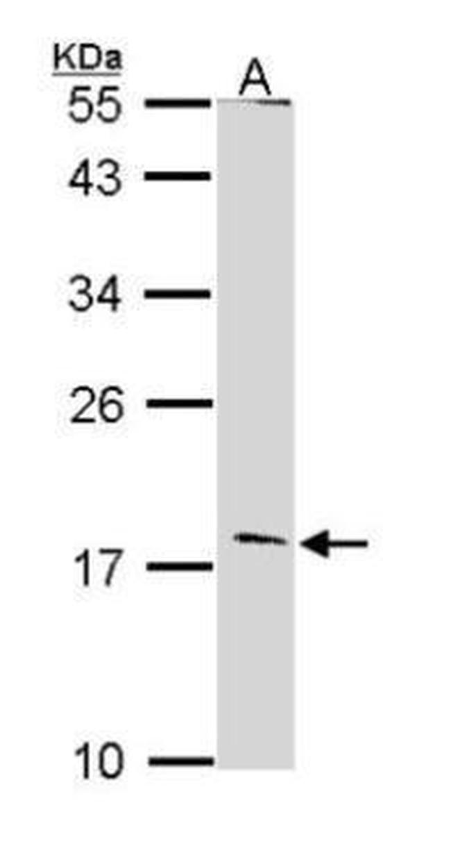 Glucagon Antibody in Western Blot (WB)