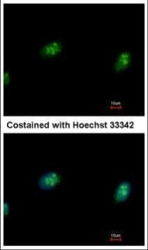 CDK4 Antibody in Immunocytochemistry (ICC/IF)