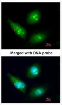 CDK4 Antibody in Immunocytochemistry (ICC/IF)