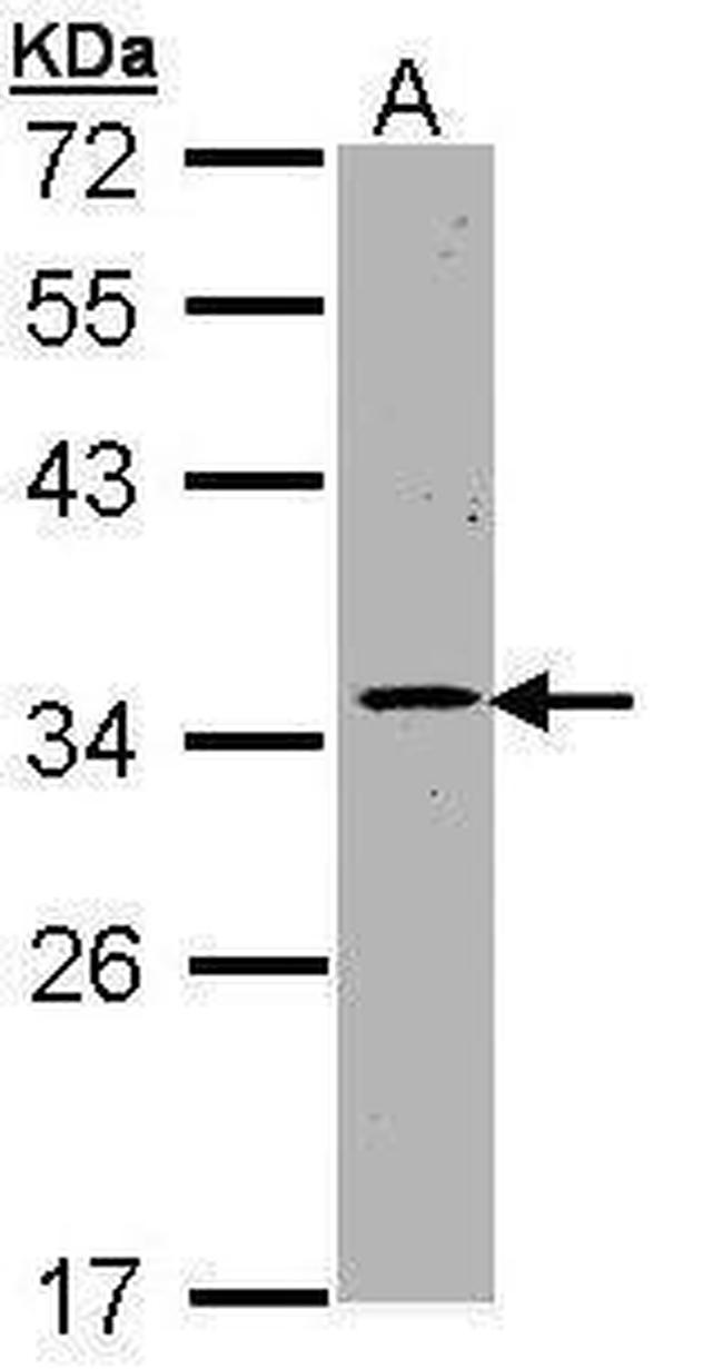 CDK4 Antibody in Western Blot (WB)