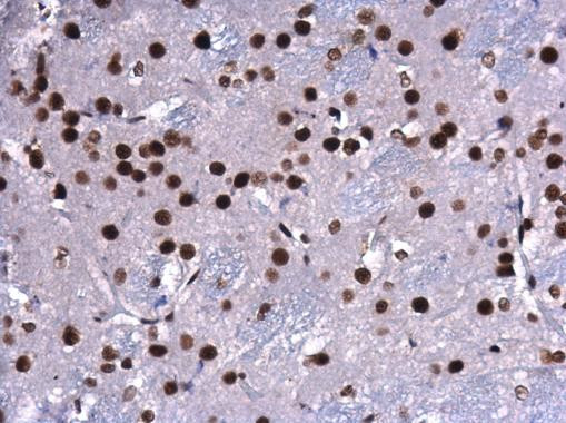 CREB Antibody in Immunohistochemistry (Paraffin) (IHC (P))