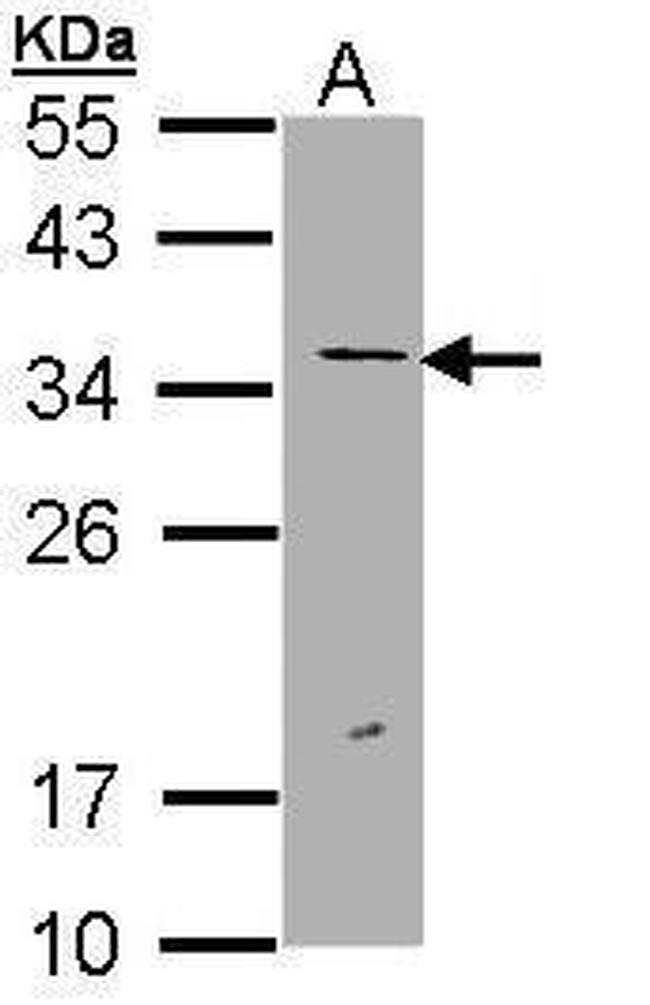 ERCC1 Antibody in Western Blot (WB)