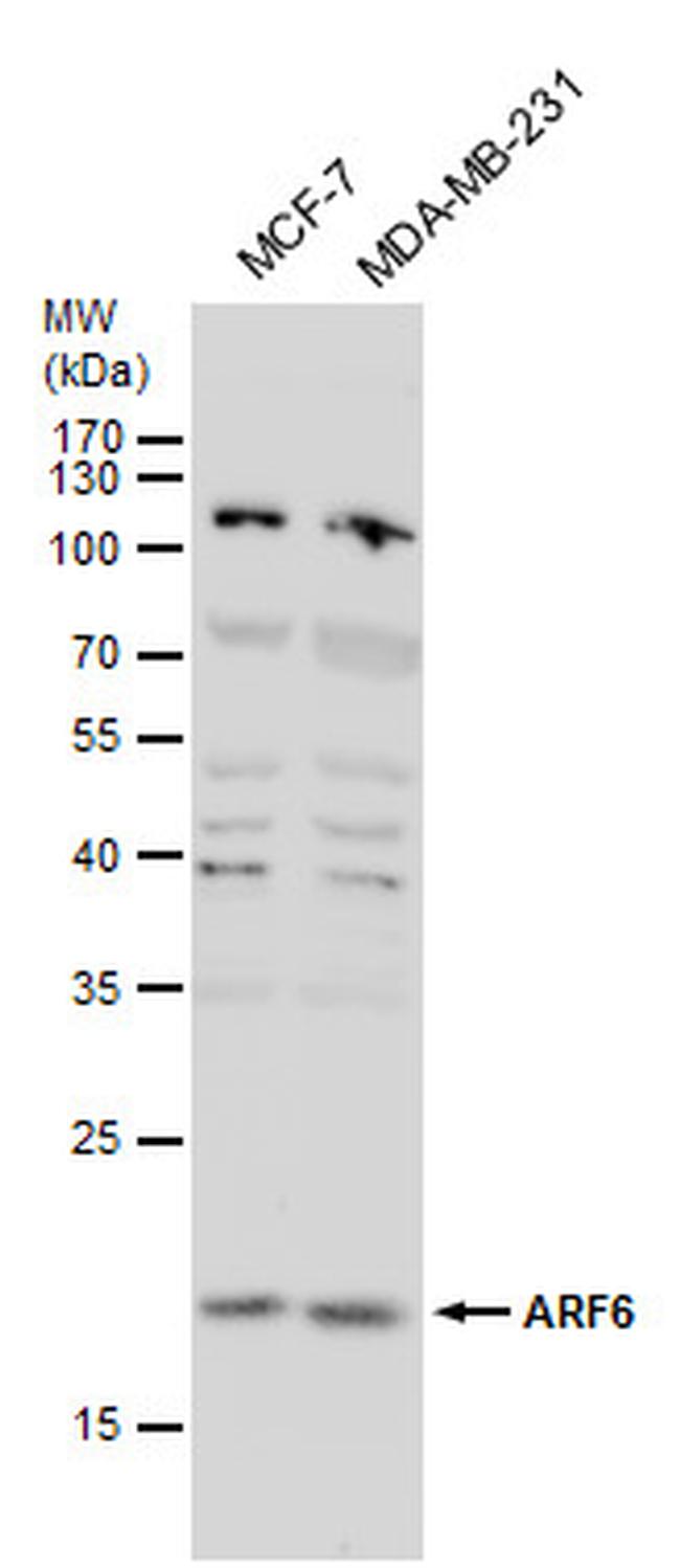 ARF6 Antibody in Western Blot (WB)