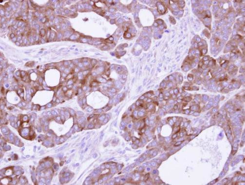 14-3-3 sigma Antibody in Immunohistochemistry (Paraffin) (IHC (P))