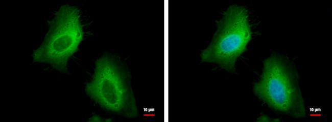 HSP27 Antibody in Immunocytochemistry (ICC/IF)