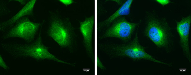 MyD88 Antibody in Immunocytochemistry (ICC/IF)