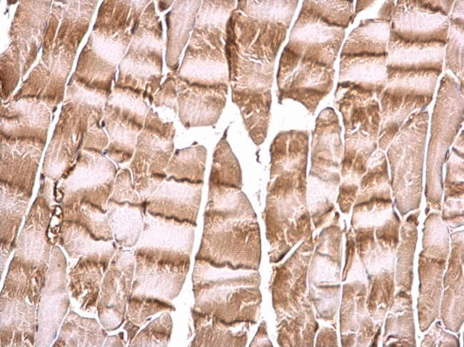 PI3K p85 alpha Antibody in Immunohistochemistry (Paraffin) (IHC (P))