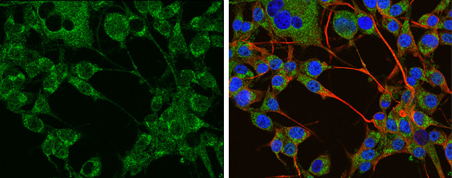 Tyrosine Hydroxylase Antibody in Immunocytochemistry (ICC/IF)