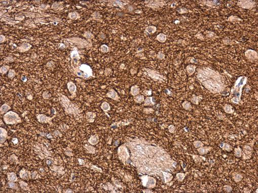 Tyrosine Hydroxylase Antibody in Immunohistochemistry (Paraffin) (IHC (P))