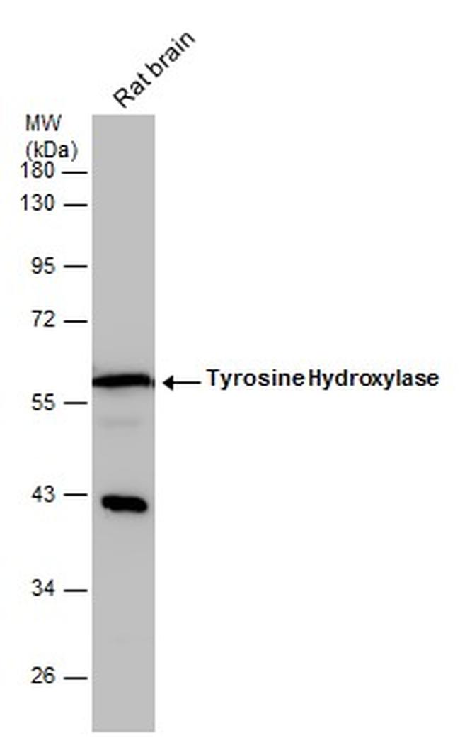 Tyrosine Hydroxylase Antibody in Western Blot (WB)