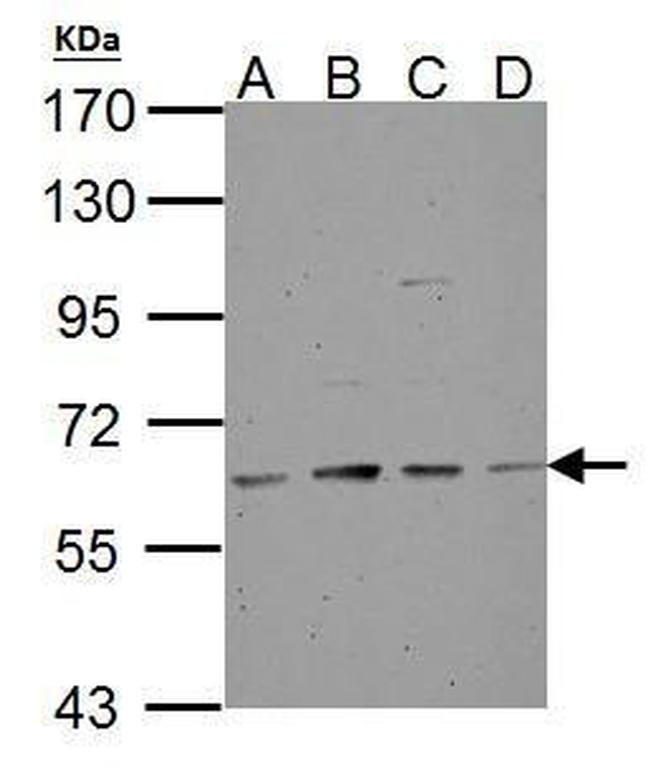 Tyrosine Hydroxylase Antibody in Western Blot (WB)