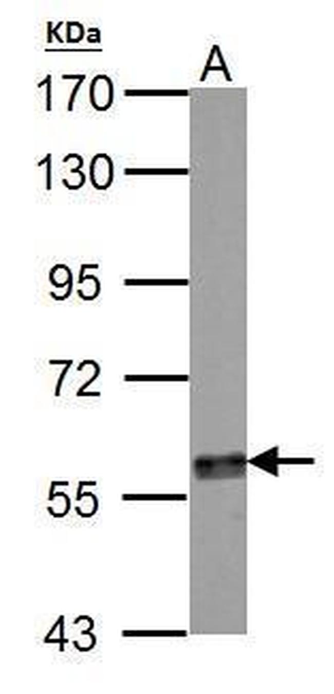 Tyrosine Hydroxylase Antibody in Western Blot (WB)