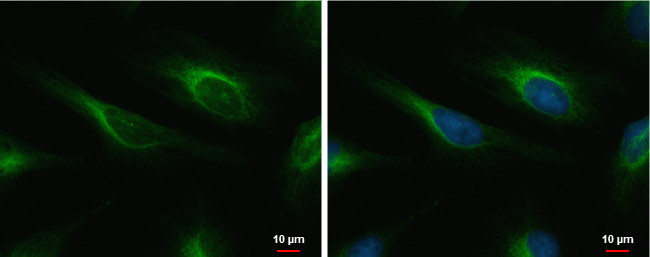 Cardiac Troponin I Antibody in Immunocytochemistry (ICC/IF)