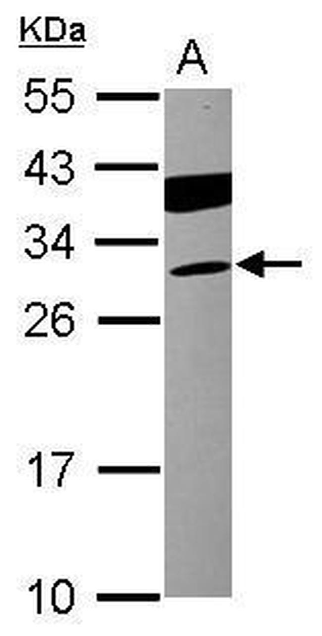 Cardiac Troponin I Antibody in Western Blot (WB)