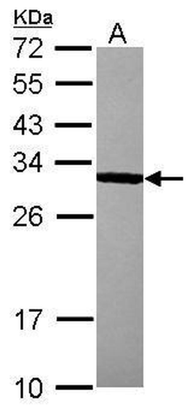 Bcl-10 Antibody in Western Blot (WB)