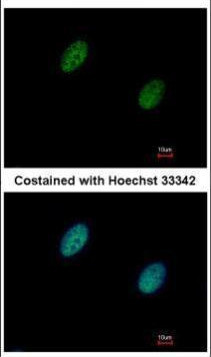 CHK2 Antibody in Immunocytochemistry (ICC/IF)