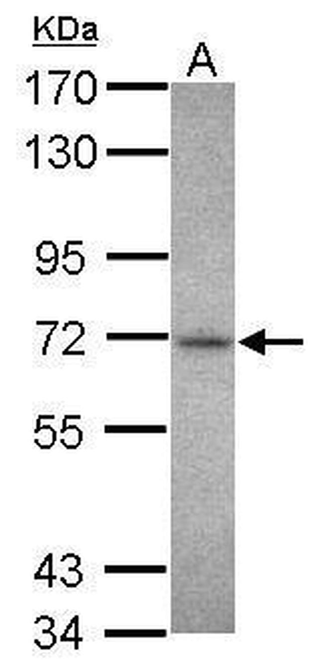 CHK2 Antibody in Western Blot (WB)