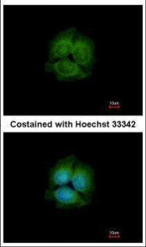 LRRK2 Antibody in Immunocytochemistry (ICC/IF)