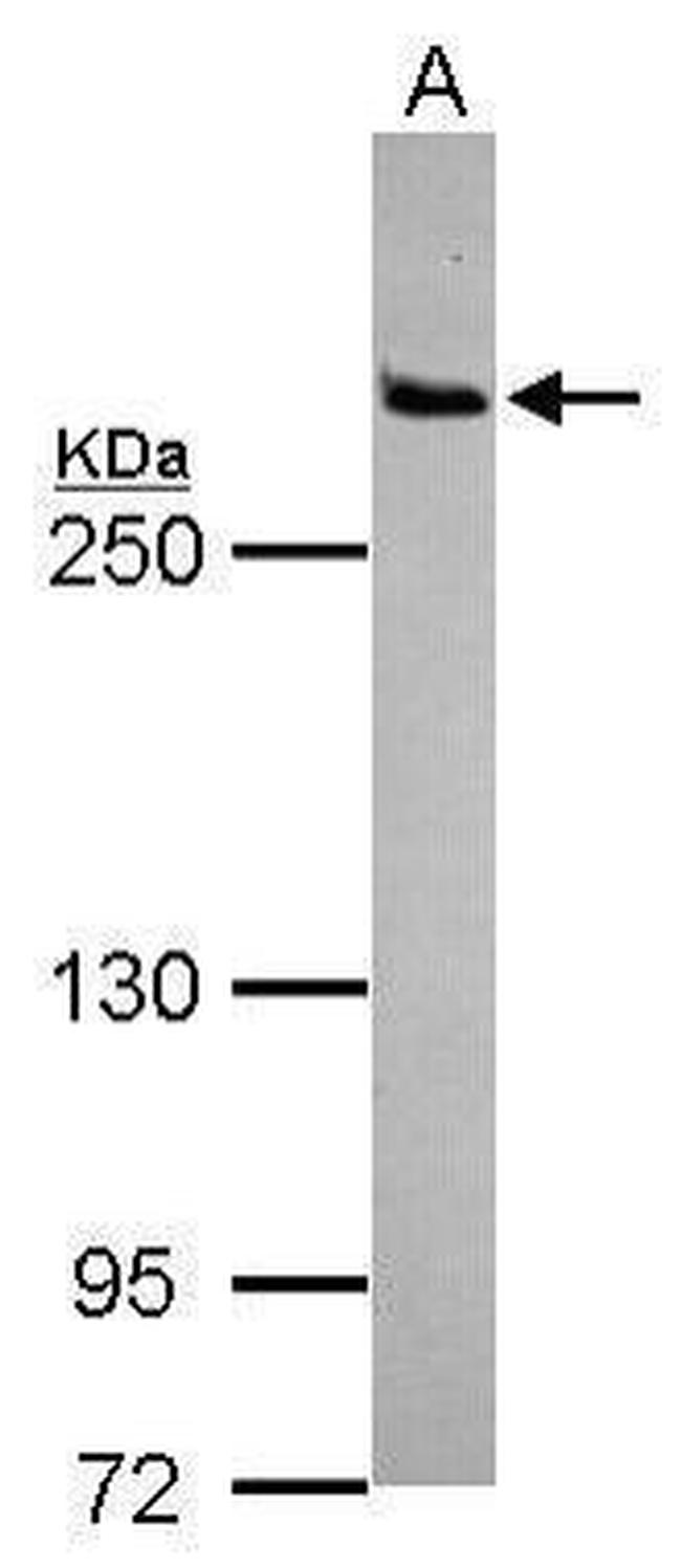 LRRK2 Antibody in Western Blot (WB)