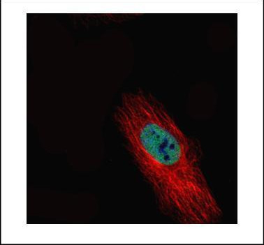 HDAC2 Antibody in Immunocytochemistry (ICC/IF)