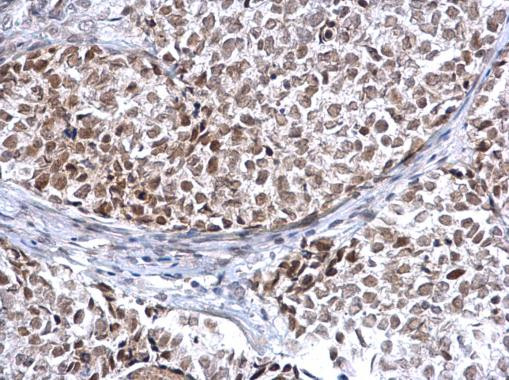 HDAC2 Antibody in Immunohistochemistry (Paraffin) (IHC (P))