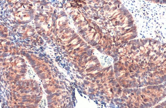 IL-1 alpha Antibody in Immunohistochemistry (Paraffin) (IHC (P))