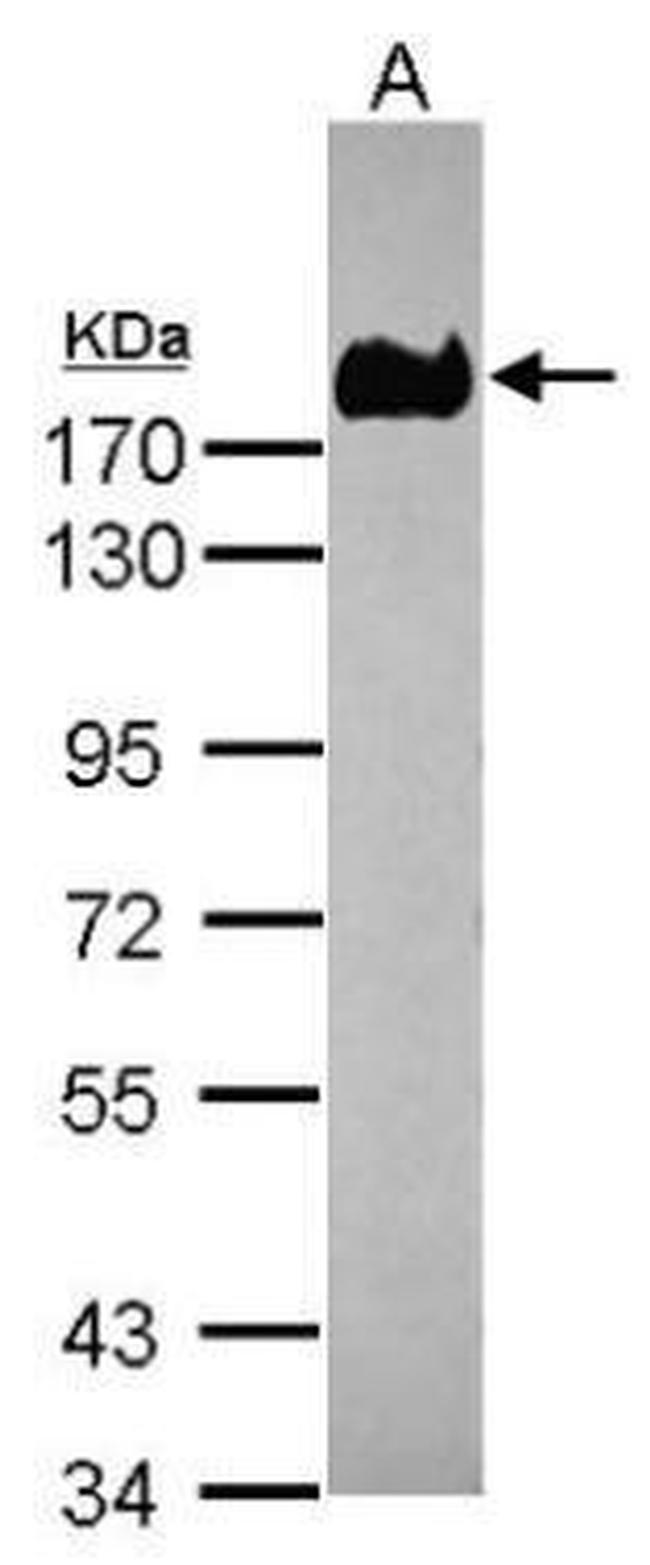 CEA Antibody in Western Blot (WB)