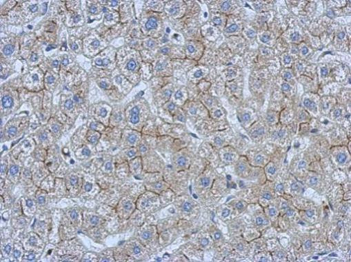 CEA Antibody in Immunohistochemistry (Paraffin) (IHC (P))