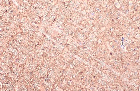 GAD67 Antibody in Immunohistochemistry (Paraffin) (IHC (P))