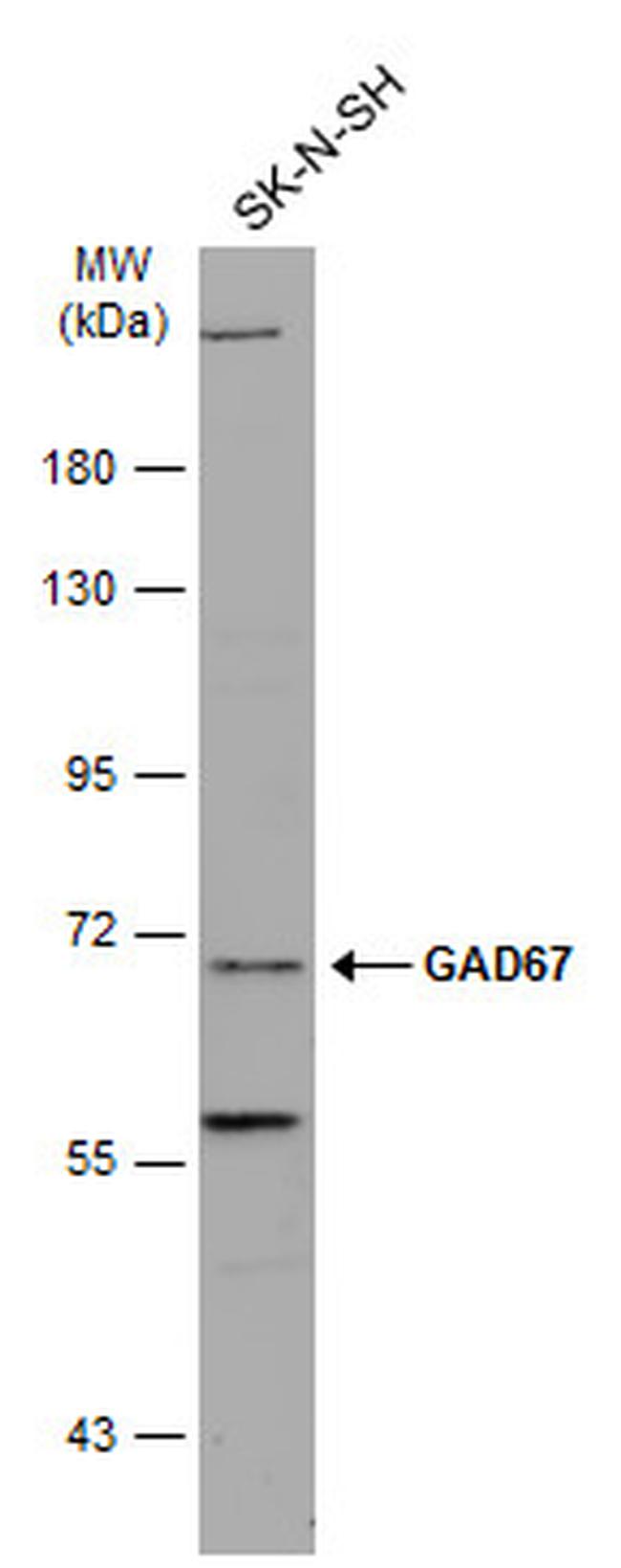 GAD67 Antibody in Western Blot (WB)