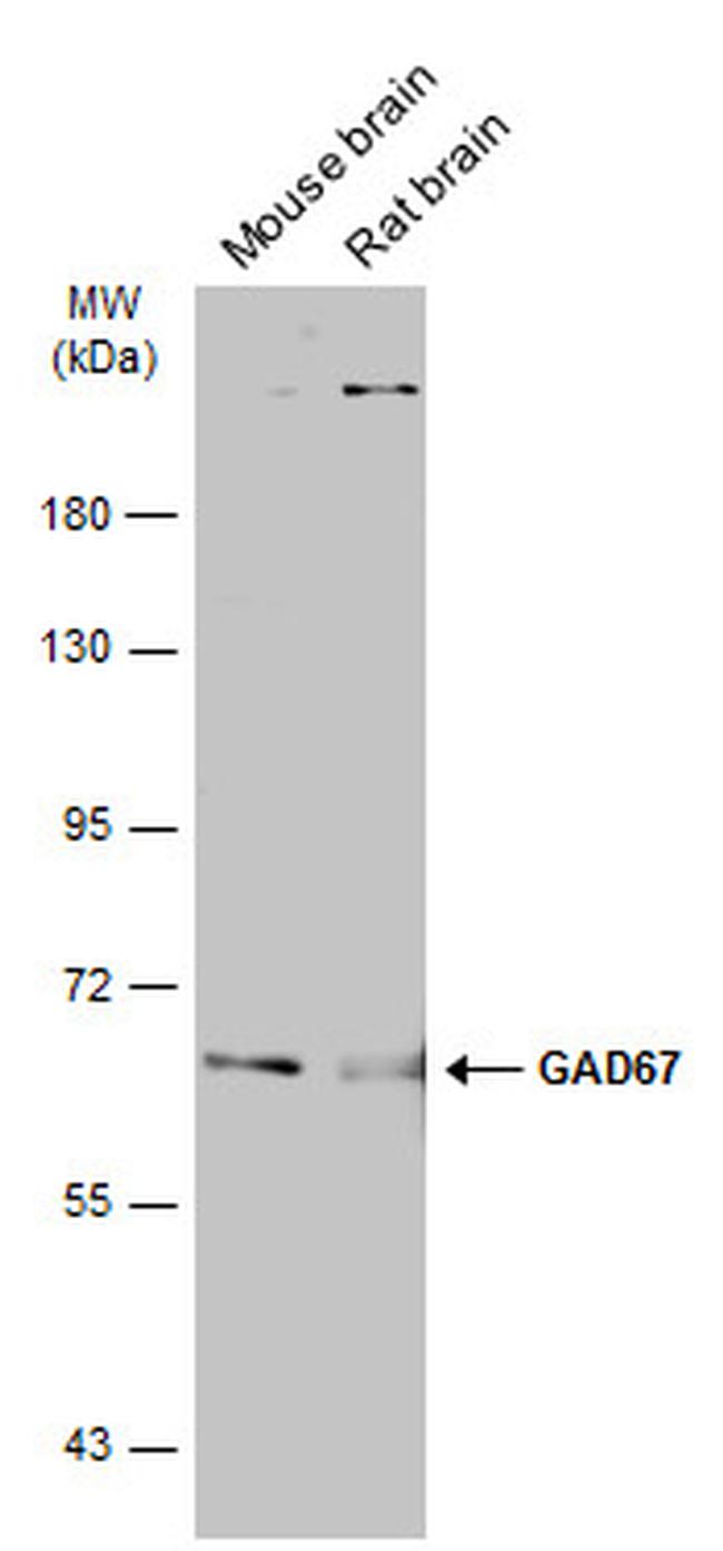 GAD67 Antibody in Western Blot (WB)