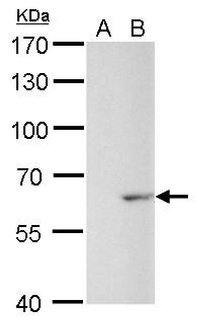 GAD67 Antibody in Western Blot (WB)