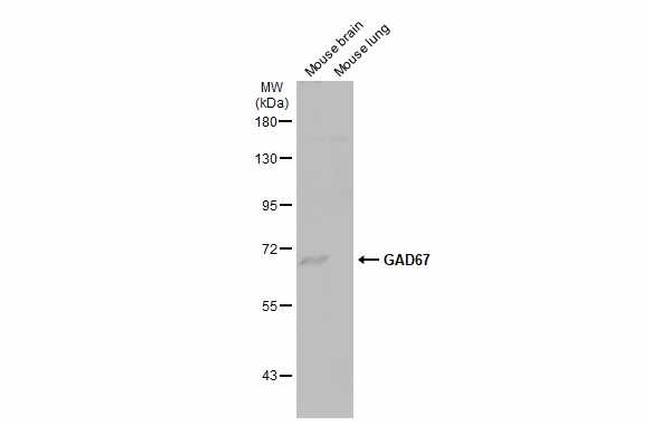 GAD67 Antibody in Western Blot (WB)