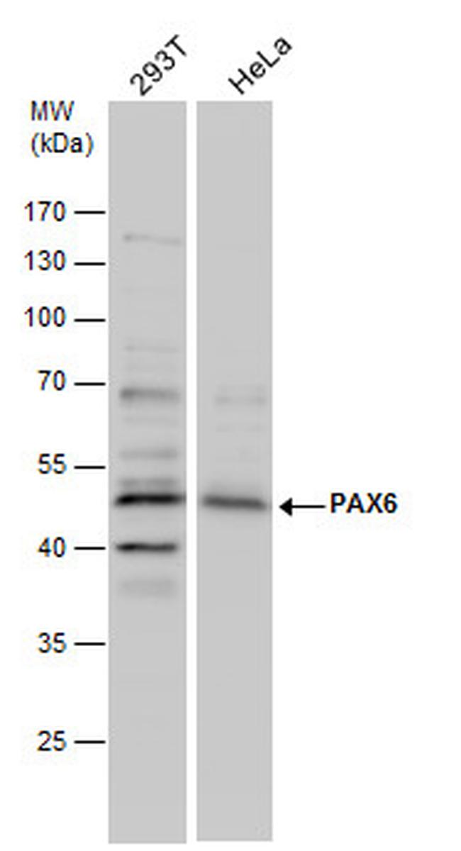 PAX6 Antibody in Western Blot (WB)