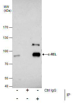 c-Rel Antibody in Immunoprecipitation (IP)