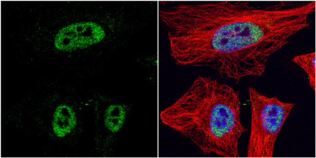 HDAC3 Antibody in Immunocytochemistry (ICC/IF)