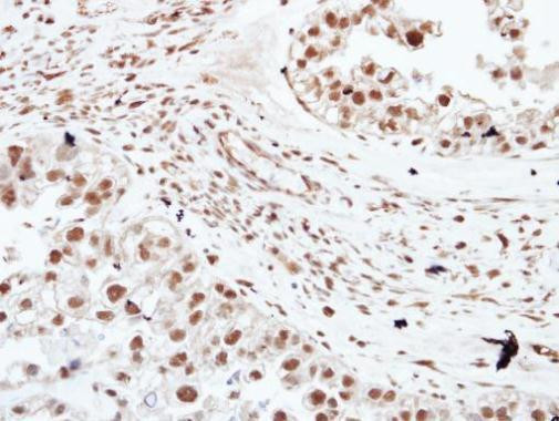 HDAC3 Antibody in Immunohistochemistry (Paraffin) (IHC (P))