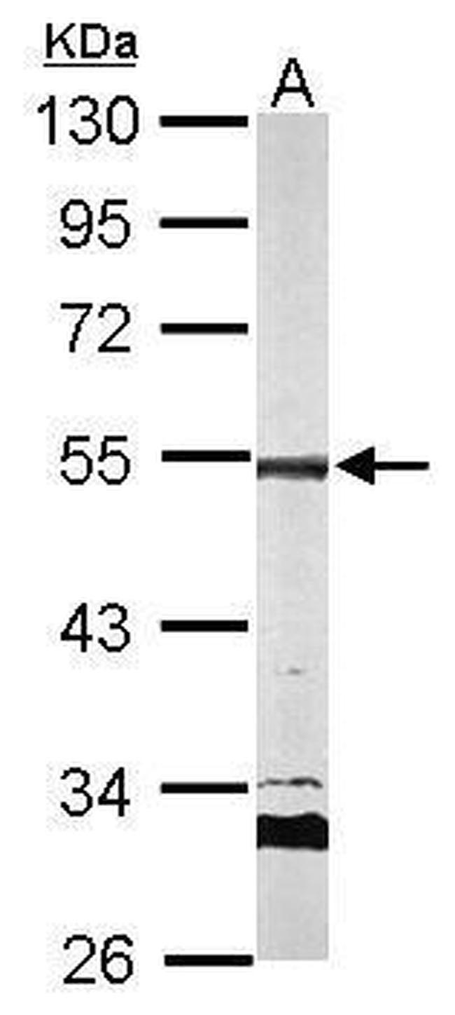 AP2M1 Antibody in Western Blot (WB)