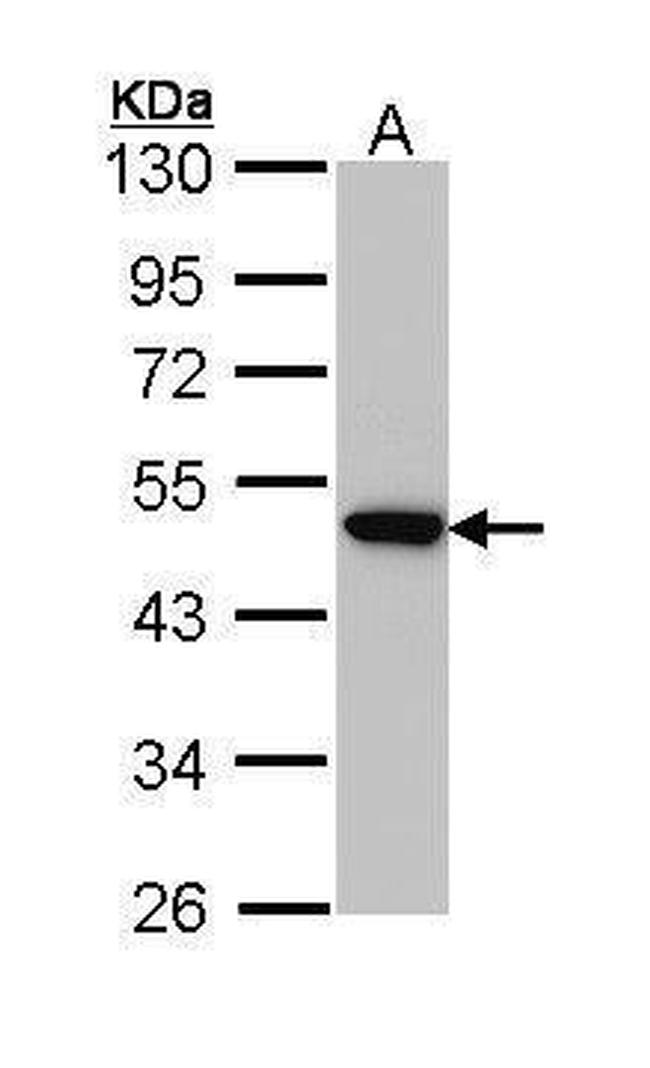 AP2M1 Antibody in Western Blot (WB)