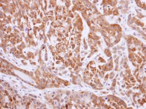 NQO1 Antibody in Immunohistochemistry (Paraffin) (IHC (P))