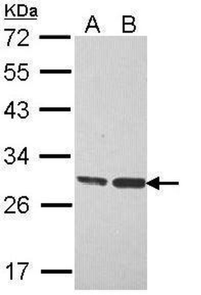 ERAB Antibody in Western Blot (WB)