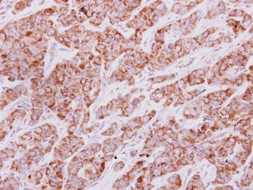 IDH3G Antibody in Immunohistochemistry (Paraffin) (IHC (P))