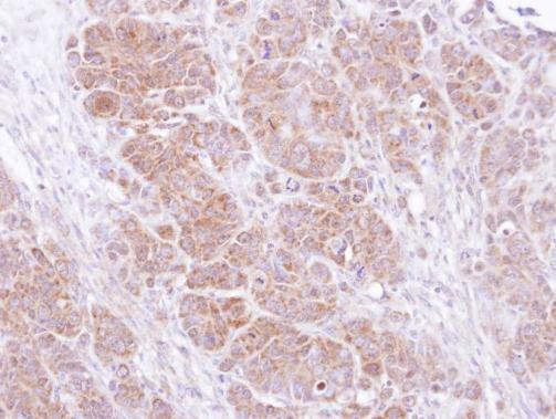 SNAP25 Antibody in Immunohistochemistry (Paraffin) (IHC (P))