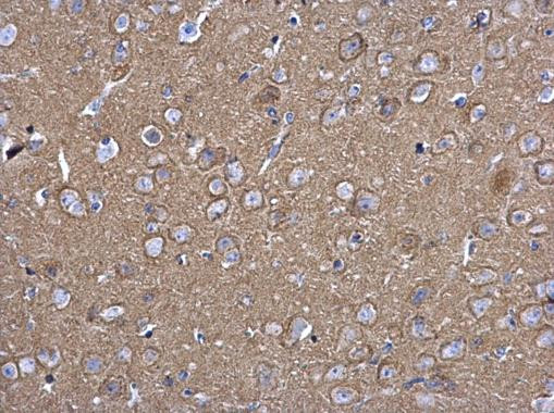 SNAP25 Antibody in Immunohistochemistry (Paraffin) (IHC (P))