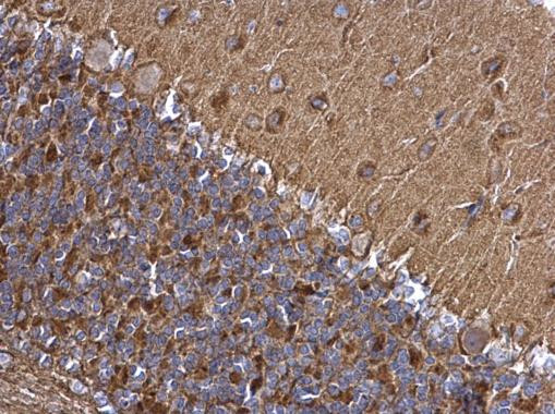 SNAP25 Antibody in Immunohistochemistry (Paraffin) (IHC (P))