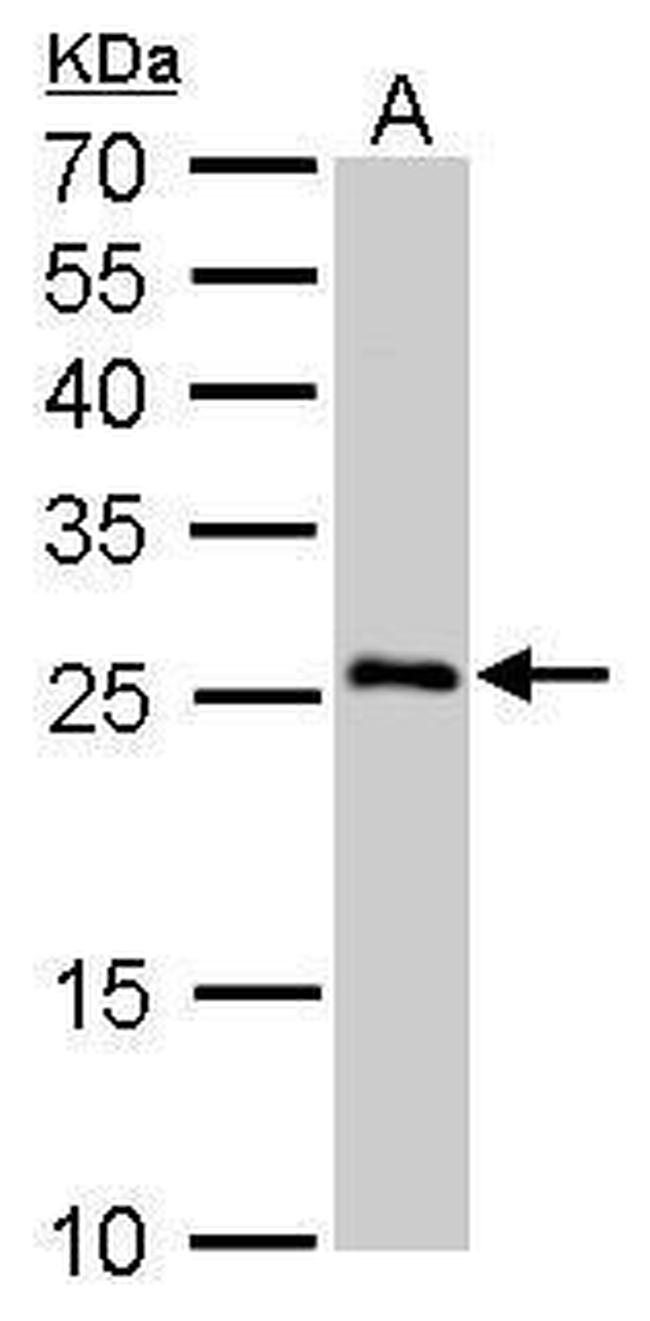 SNAP25 Antibody in Western Blot (WB)