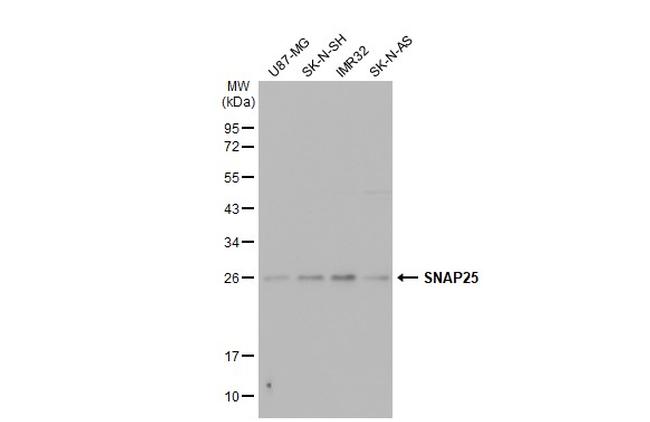 SNAP25 Antibody in Western Blot (WB)