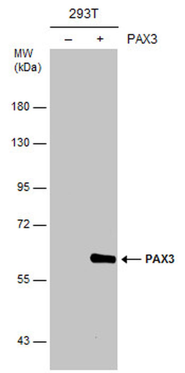 PAX3 Antibody in Western Blot (WB)