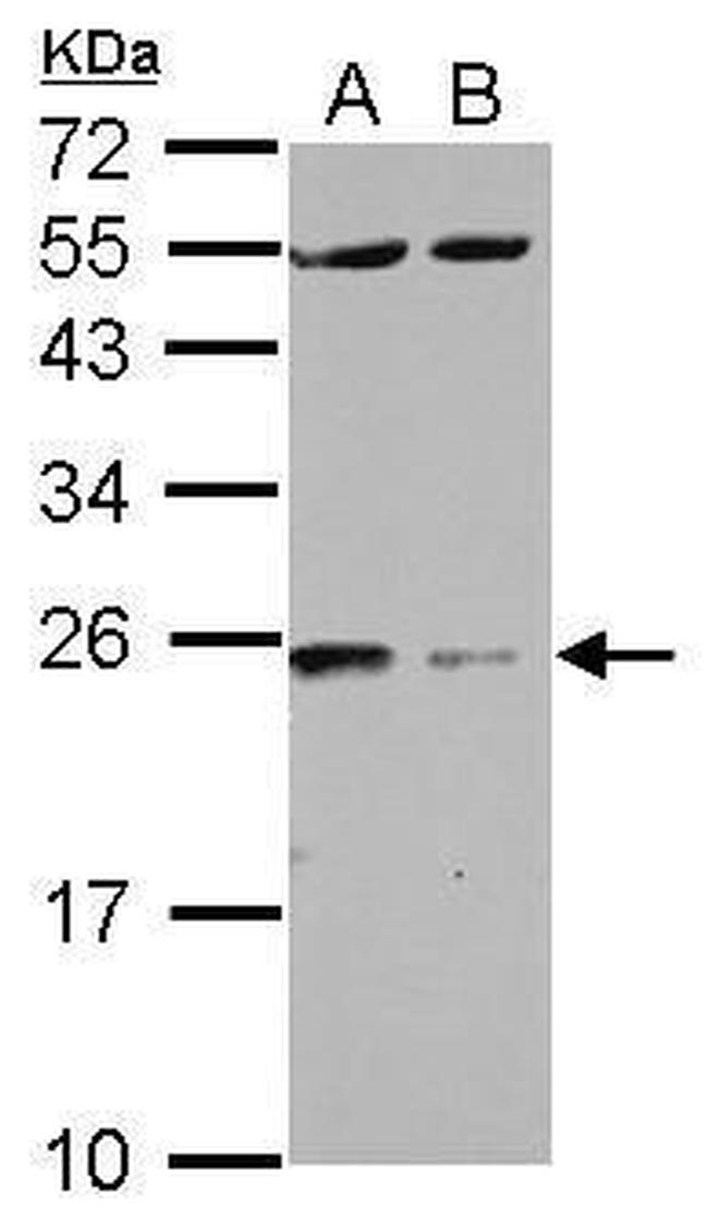 14-3-3 zeta Antibody in Western Blot (WB)